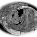 Soundbite Medical Solutions logo